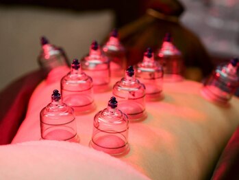 たかさき整骨院/カッピング