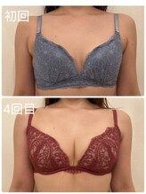 美人バスト 新宿店/☆姉妹店バストアップ症例写真☆