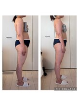 ハートエルボー(Heart elbow)/3回目のボディ