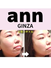 アン 銀座(ann)/レモンボトル