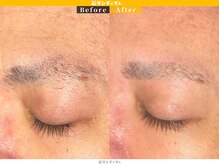 眉ダンディズム 大阪天神橋六丁目店/お客様Before/After