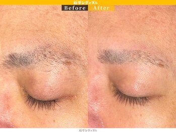 眉ダンディズム 大阪天神橋六丁目店/お客様Before/After
