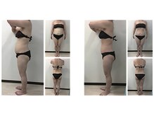 ミネルバエンダモロジー/エンダモロジー/痩身/ウェルネス