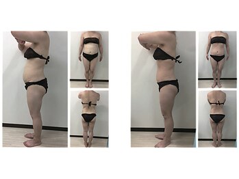 ミネルバエンダモロジー/エンダモロジー/痩身/ウェルネス