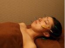 ハリラックス(HA:Ri/LAX)/【美容鍼灸の様子】