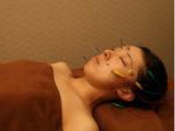 ハリラックス(HA:Ri/LAX)/【美容鍼灸の様子】