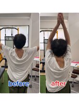 サンシー整体(SunCY整体)/５０代女性