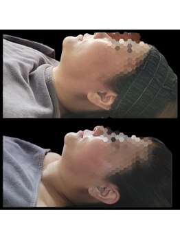 ベリー(Berry)/人気上昇中♪レモンボトル