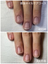 ネイルブルームーン(Nail Blue Moon)/最強ネイルケアコース