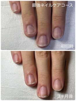 ネイルブルームーン(Nail Blue Moon)/最強ネイルケアコース