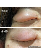 ジェネ鍼灸院/眼のお困りにも対処します！