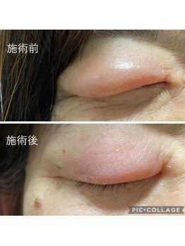 ジェネ鍼灸院/眼のお困りにも対処します！