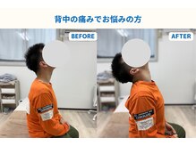 琴似じんぼ整体院/背中の痛み、整体後の変化