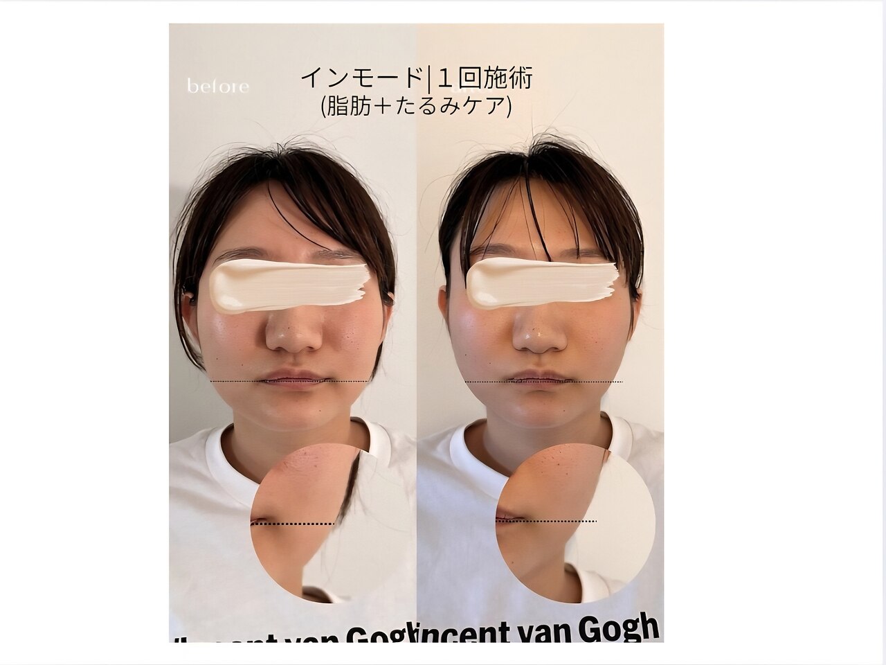 サンク(cinq)｜ホットペッパービューティー