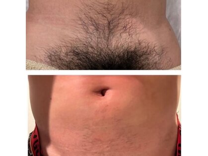 ビジュツ(BIJYUTSU)の写真