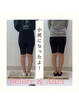 スタイルラボ高松/産後の骨盤矯正の効果♪