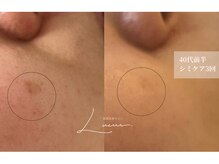 リュール(Lueur)の雰囲気（一度のケアでも変化を実感。明るく透明感のある肌へ）