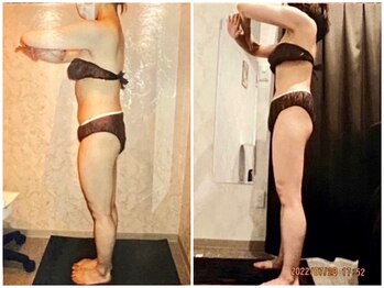 パーフェクトボディプレミアム 大阪難波店(PERFECT BODY PREMIUM)/お客様 ビフォーアフター(27)