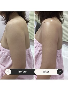 ユウキ(yuuki)/夏直前！自信を持って腕出して！