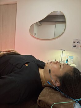 ハリファ鍼灸院 熊本院(HariFa鍼灸院)/美容鍼