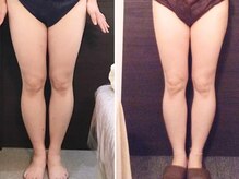 美容整体 ウェリナ 蟹江院/小顔矯正/骨盤矯正/美脚サロン