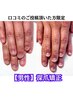 【深爪矯正口コミのご投稿を頂いた男性限定】¥31900→¥30800
