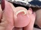 シックネイル(CHIC NAIL)の写真/《巻き爪でお悩みの方に》ケアしづらい巻き爪に。痛みの少ない丁寧な施術で長年の爪のお悩みを解消します◎