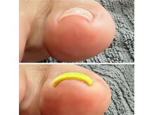 アンドネイル(+ and Nail)の雰囲気（特許取得済ジェルで巻き爪ケア+フットネイルを楽しめる[立川]）