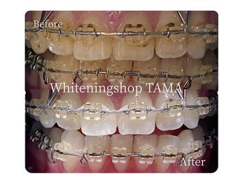 ホワイトニングショップ 多摩店/