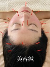 リュウ鍼灸院 サロン ド リュウ(Salon de Ryu)/小顔美容鍼