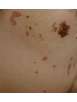 ネイル&エステ Sur【シュール】/