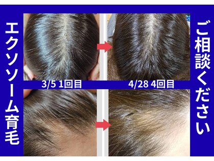 アン 銀座(ann)の写真