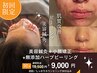 【１日1名限定】NEW！効果がすごい！和漢ピーリング+美容鍼(90分)
