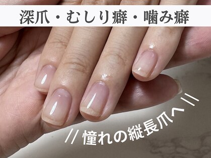 アメジスト(Amethyst)の写真