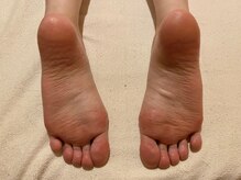 ビサンテ サロン/10)足の乾燥,荒れに角質育成ケア