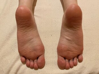 ビサンテ サロン/10)足の乾燥,荒れに角質育成ケア