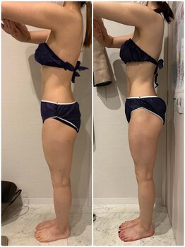 ブレス 天童店(BLESS)/セルゼロ半身5回目