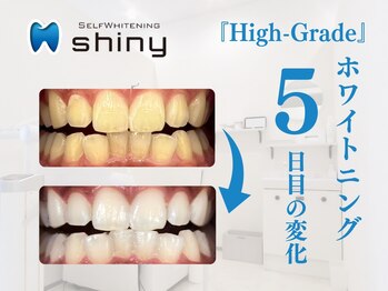 ホワイトニングサロン シャイニー 浜松細島店(shiny)/【超絶・美・白】ホワイトニング