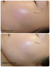 小野小町のかかりつけ/アンストレス　ビフォーアフター