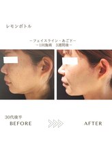サロンエイトミー 西船橋店(salon 83)/レモンボトル/before→after