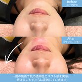 ハーモニー(Harmony)