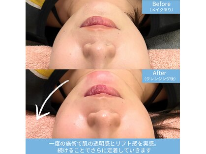 ハーモニー(Harmony)の写真