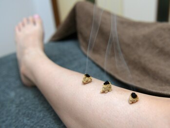 大星鍼灸院の写真/刺さない鍼で初めての方にもオススメ♪原因不明の不調や自律神経の乱れなどのお悩みに◎【初回¥3,980】