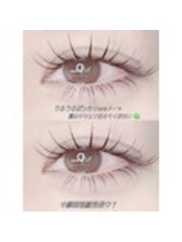 アムラット(amlat)/お悩みの方は参考に