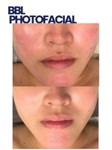 モミン(MOMI.N)/肌を綺麗にしたい！