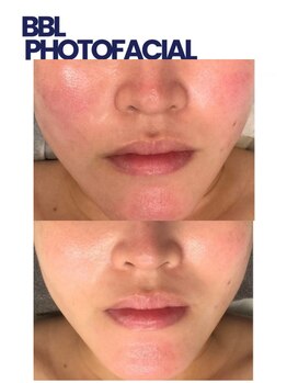 モミン(MOMI.N)/肌を綺麗にしたい！