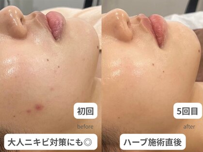 ウィンク 勝どき(wink)の写真