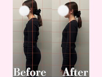 アルピラティス 池尻大橋(AruPilates)/辛い腰痛は反り腰からかも？