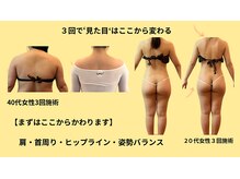 プライベートサロン やすらぎ/3回で首 肩周りすっきり！