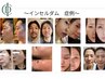 韓国発！本気の肌質改善！すべての肌悩みに♪水光肌体験【インセルダム】